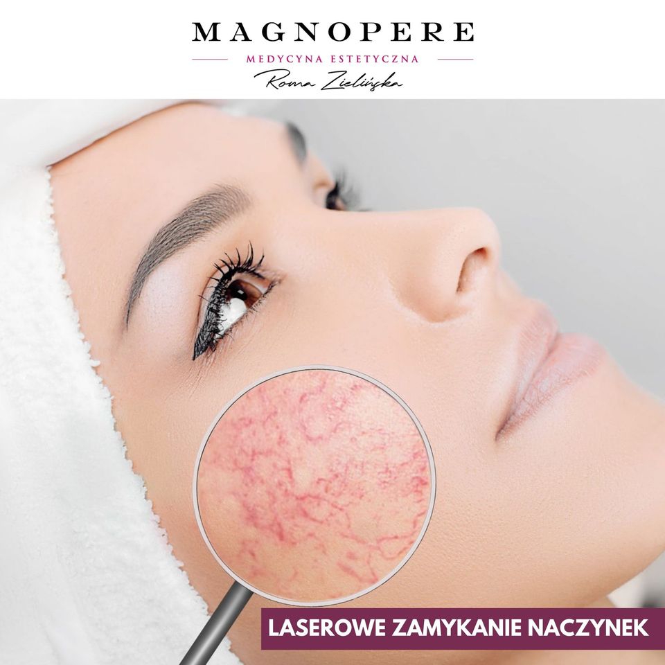 Zamykanie naczynek w gabinecie Magnopere